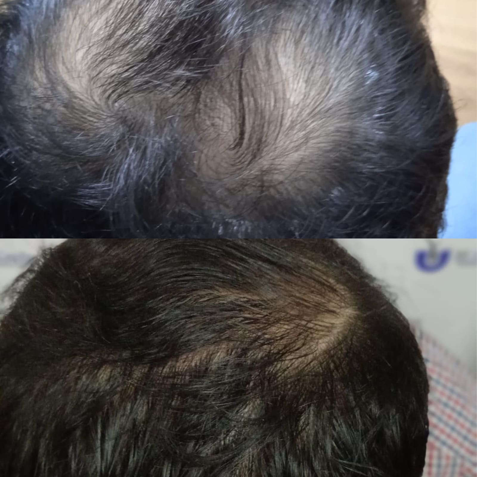 testimonio-de-tratamiendo-para-la-caida-del-cabello